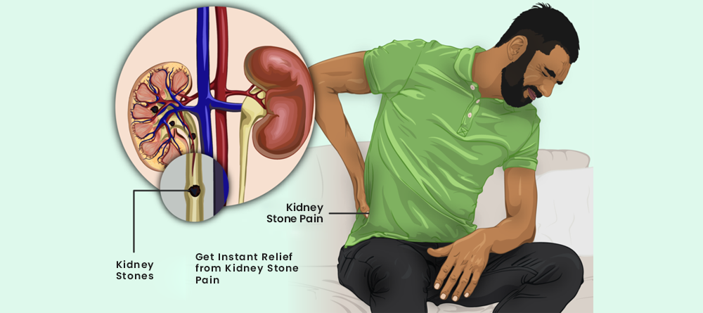 how to get instant relief from kidney stone pain