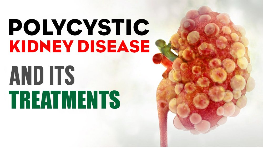 Causes and symptoms of Polycystic kidney disease in Ayurveda